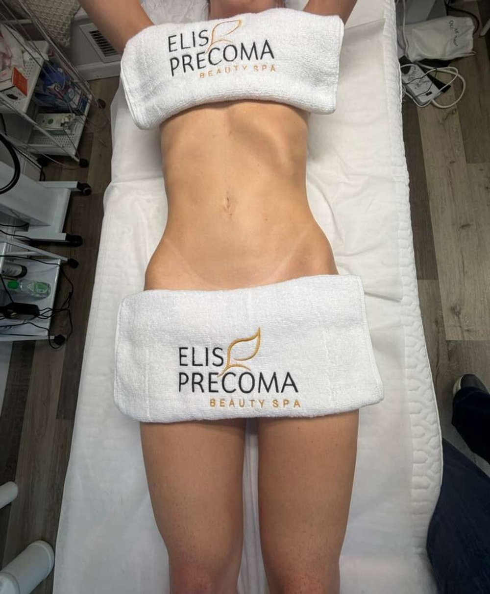 Abdomen after a body contouring session